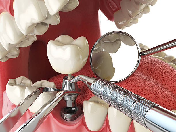 Best Emergency Care for Gum Disease in Ladue, MO